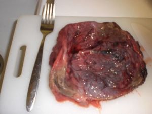 Placenta 4.jpg